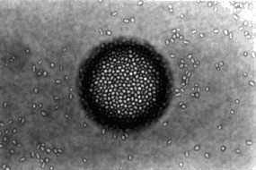 Foto ampliada das células de leveduras aderidas ao redor da bolha de ar, ainda imersa no líquido